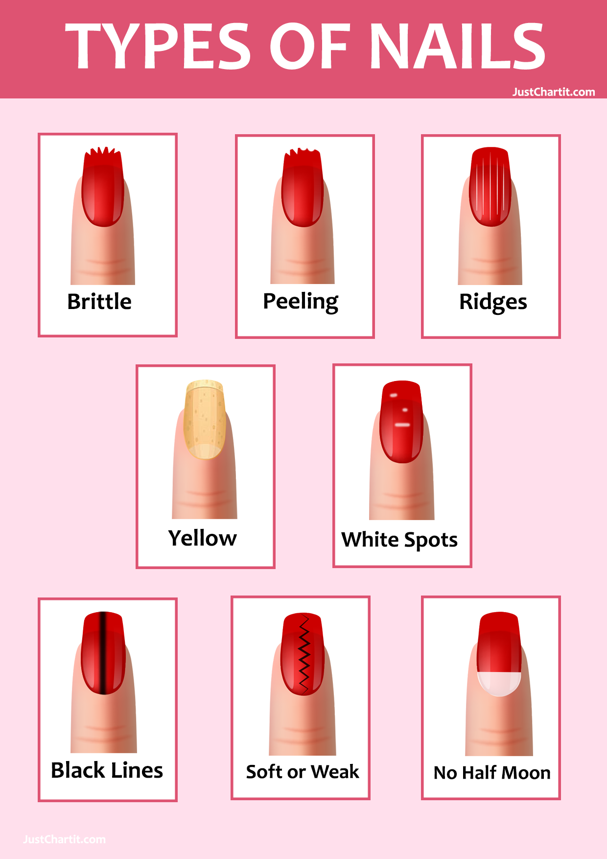 Nail Health Chart