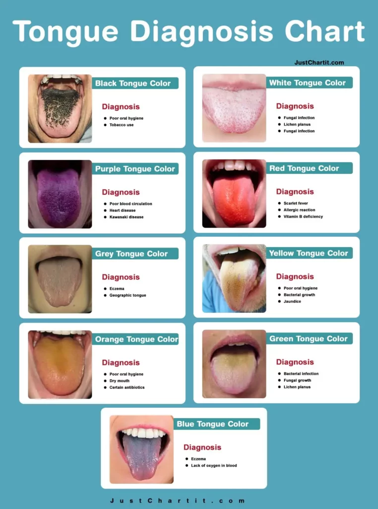 tongue diagnosis chart